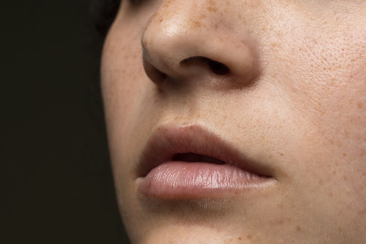 Blog Farmacia ZÔrate 4 - Farmacia ZÔrate en Icod de los Vinos Manchas solares en la cara por qué aparecen y cómo prevenirlas